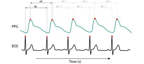 Image result for Heart Rate Variability Test