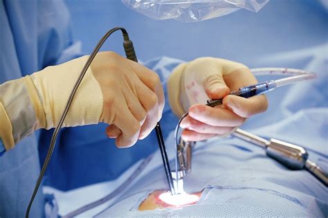 Best Cardiac Surgery hospitals in Secunderabad | Best Cardiologist in ...