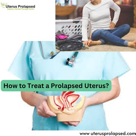 What Happens If a Prolapse is Left Untreated?