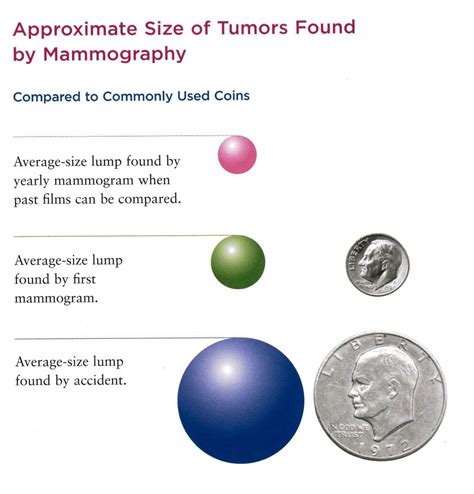 How Big Is A 2 Cm Tumor at Leonard Conatser blog