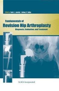 Fundamentals of Revision Hip Arthroplasty: Buy Fundamentals of Revision ...