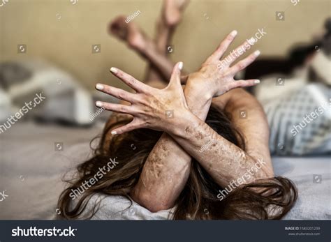 Image result for Examples of Mutilation