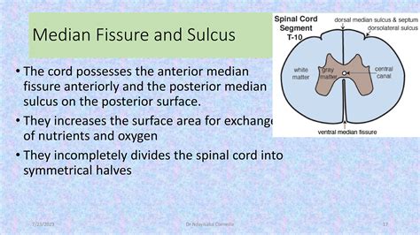 Anterior Median Fissure