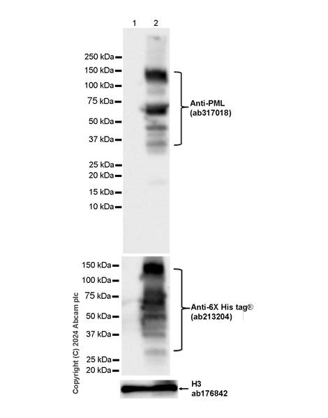 Anti-PML Protein antibody [EPR27157-75] (AB317018) | Abcam, India