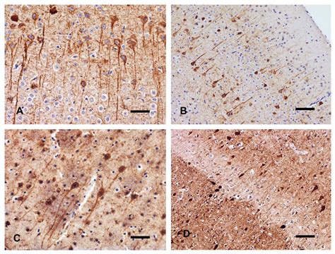 Morphological and Immunohistochemical Changes in Progressive Postmortem ...