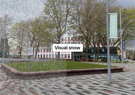 Image result for Visual Snow Simulator