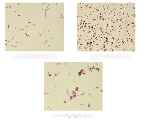 Image result for Bacteria Microscope Slides