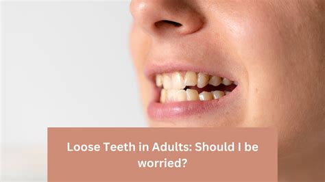 Loose Tooth Adult