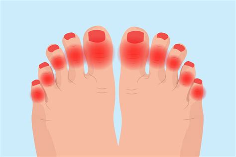 Pain In Toes