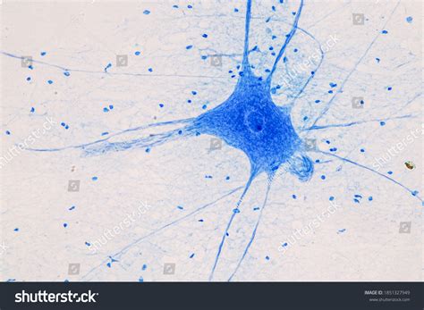 Education Spinal Cord Motor Neuron Under Stock Photo 1851327949 ...
