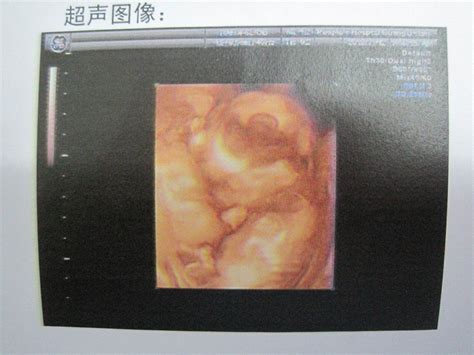 怀孕19周，胎儿头围正常值是多少？ - 知乎