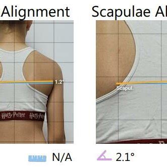 Image result for Posture From Back View Alignment