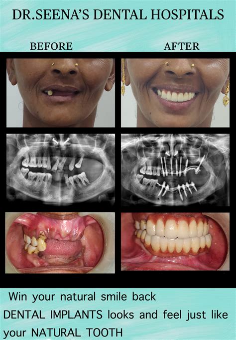 Dr. Seena'S Dental in Kompally,Rangareddy - Best Dentists near me in ...