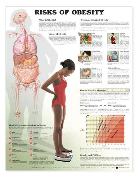Buy Risks of Obesity Anatomical Chart Book Online at Low Prices in ...