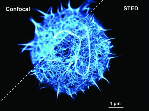 Cell Biology Image Gallery | Learn & Share | Leica Microsystems