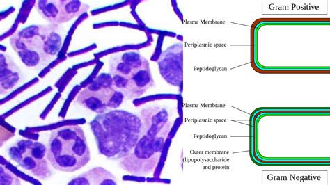 Escherichia coli(E. coli) morphology, arrangement, Cultural ...