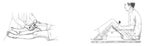 Anterior Cruciate Ligament Tears | JointSurgery.in