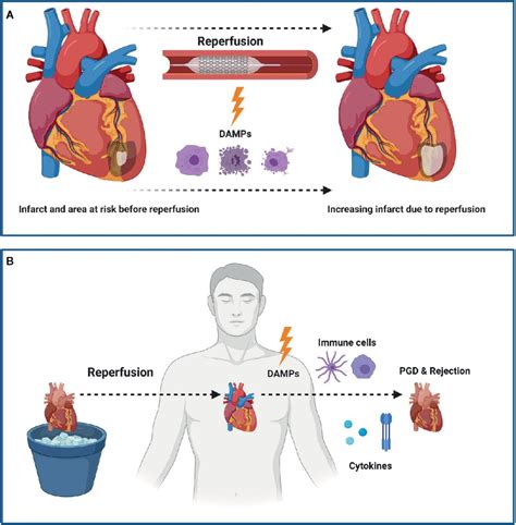 Understanding Myocardial Infarction: Signs, Symptoms, and Treatments to Save Your Life – HTT Network