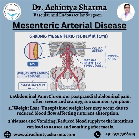 Needs to understand about Mesenteric Artery Disease Symptoms
