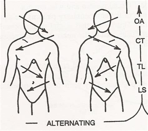 Image result for Common Compensatory Pattern