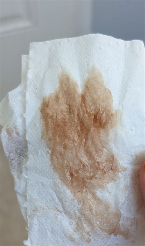 Bloody Discharge Pregnancy