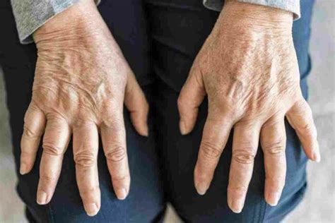 Does Hadjod really help people with arthritis? - THIP Media