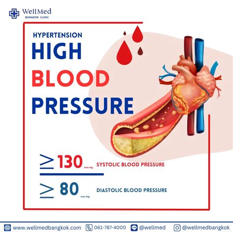 Risk factors for High Blood Pressure (Hypertension)? | WellMed Bangkok Clinic 2025