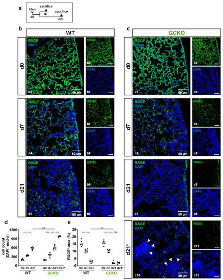 Anti-Fibrotic and Anti-Inflammatory Role of NO-Sensitive Guanylyl ...