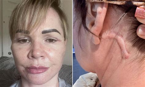 Businesswoman who flew to Lithuania for £7k surgery was left 'with ...