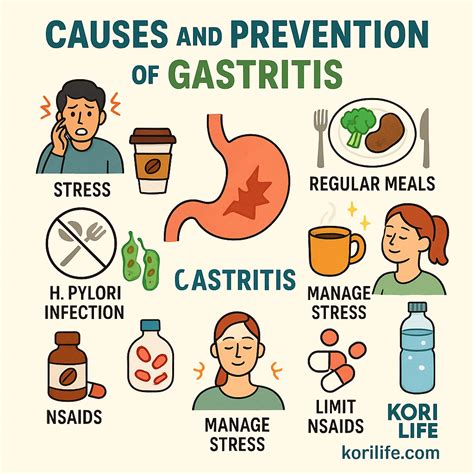 How To Deal With Gastritis: A Practical Guide To Relief