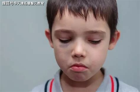 天津儿童自闭症康复训练：中国自闭症最新的自闭症率有多少？_患者