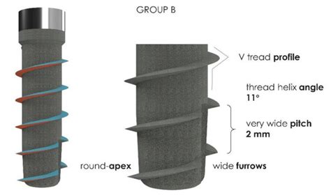 The Effect of Threads Geometry on Insertion Torque (IT) and Periotest ...