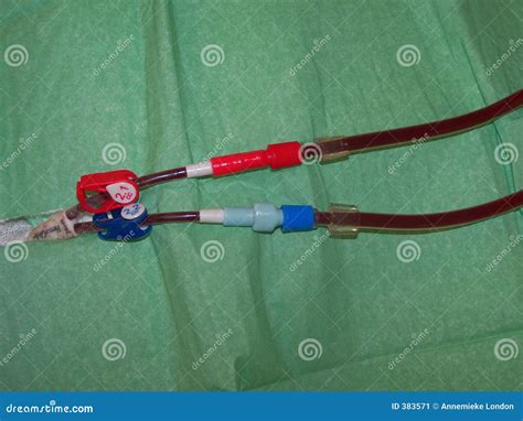 Dialysis Catheter Length Internal Jugular at Edward Call blog