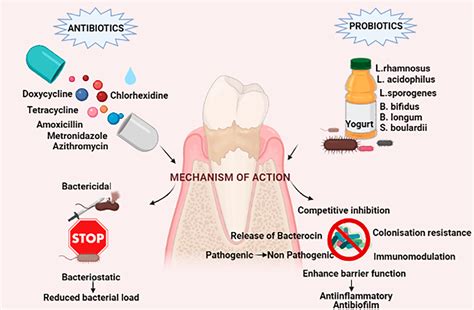 Antibiotics For Gum Disease