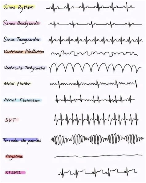 Pin de Kelly Lovold en How to save a life en 2025 | Anatomía, Enfermeria, Estudio