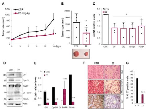 A Smo/Gli Multitarget Hedgehog Pathway Inhibitor Impairs Tumor Growth