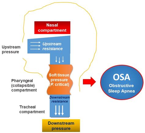 Personalized Medicine and Obstructive Sleep Apnea