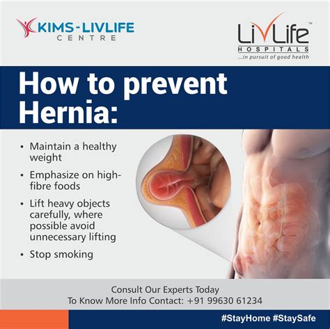 How To Reduce Hernia - Calendarinternal21