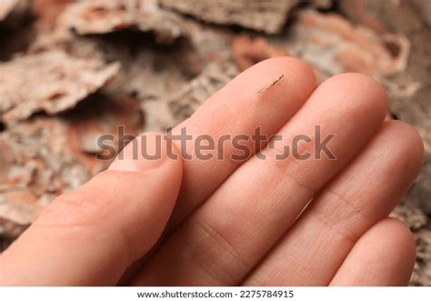 Splinter Finger 的图像结果