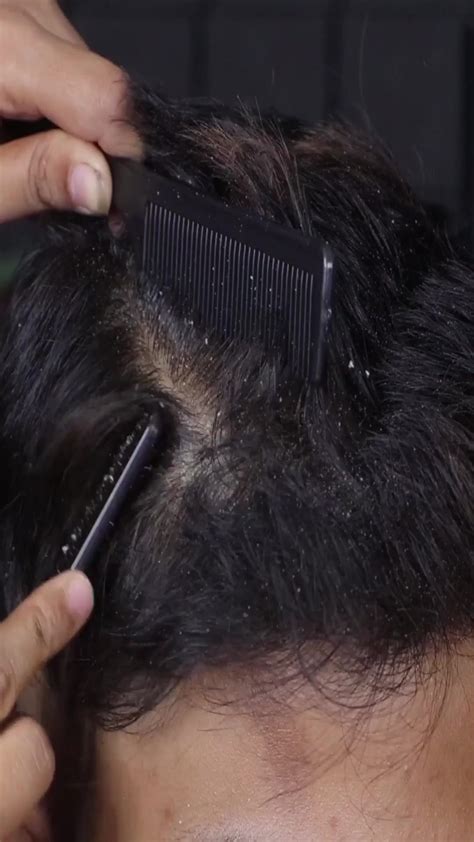 Image result for Back Cracking Massage