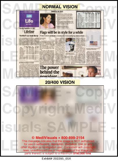 Image result for 20 400 Vision Example