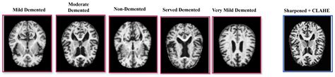 Hybrid Deep Learning Architecture with Adaptive Feature Fusion for ...