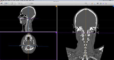 Image result for 3D Scanning Forensics