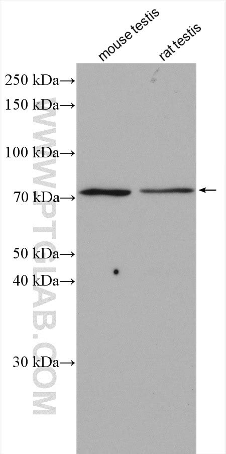 PAK6 antibody (13539-1-AP) | Proteintech