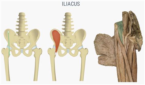 Iliacus Muscle Pain