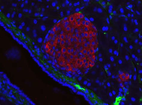 Breakthrough Diabetes Cell Therapy Could Be A Game Changer – Lifeboat ...