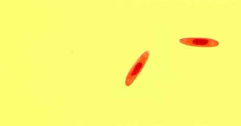 Flies Turn Into Zombies From Fungi Infection