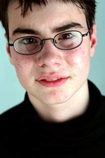 Guide Compléments Alimentaires contre l'Acné | AlterPhyto