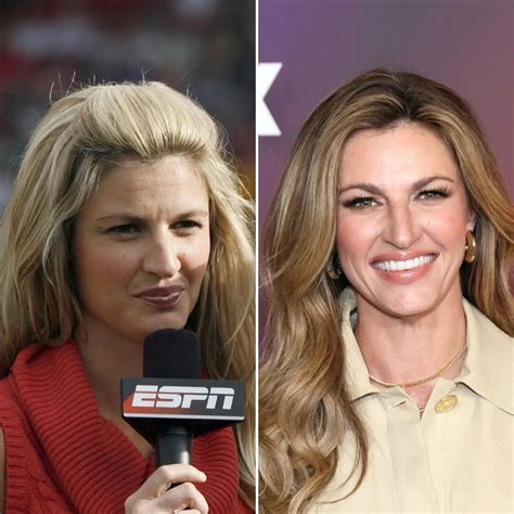 Erin Andrews Plastic Surgery: A Closer Look | Bizrahmed