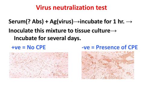 Neutralization Test 的图像结果